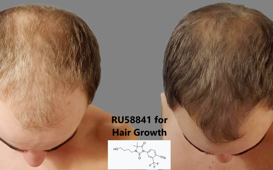 RU58841 for Hair Growth