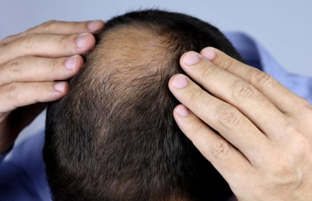 Sugar Gel for Hair Regrowth?